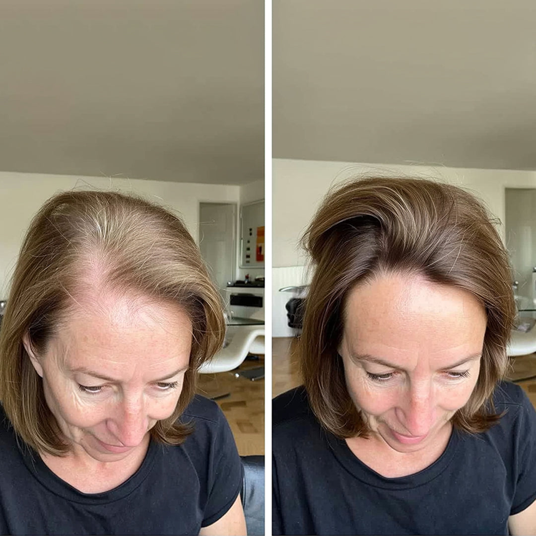 Miréa Haargroei Spray